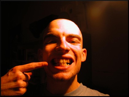Dentatura imperfetta